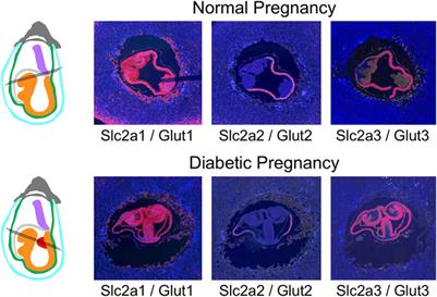 Nutrient Transporter Gene Expression in the Early Conceptus—Implications From Two Mouse Models of Diabetic Pregnancy